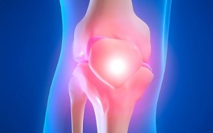 Αιτίες της οστεοαρθρίτιδας της άρθρωσης του γόνατος