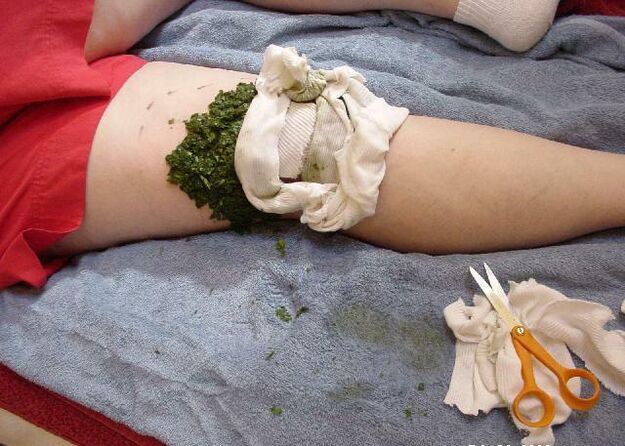 Μια ζεστή κομπρέσα από πολτοποιημένα φύλλα λάχανου σε μια πονεμένη άρθρωση του γόνατος με οστεοαρθρίτιδα